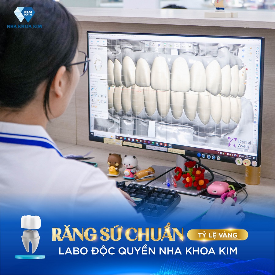 Nha Khoa Kim sở hữu Labo sản xuất răng sứ độc quyền (nhà máy răng sứ A&B)