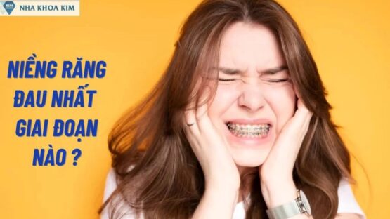 Niềng Răng Đau Nhất Giai Đoạn Nào – Giải Đáp Thắc Mắc Chi Tiết