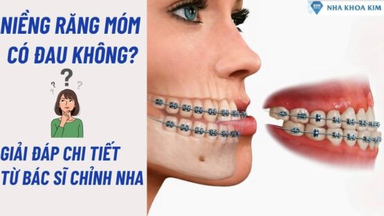 Niềng Răng Móm Có Đau Không? Giải Đáp Từ Bác Sĩ Chỉnh Nha