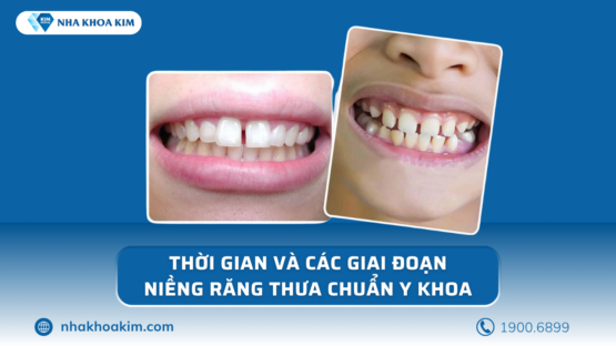 Tìm hiểu các giai đoạn niềng răng thưa chuẩn Y khoa