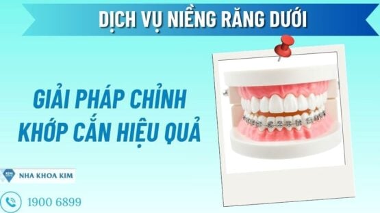 Dịch Vụ Niềng Răng Dưới: Giải Pháp Chỉnh Khớp Cắn Hiệu Quả