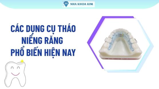 Các Dụng Cụ Tháo Niềng Răng Phổ Biến Hiện Nay