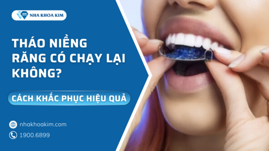 Tháo niềng răng có chạy lại không? Cách khắc phục hiệu quả