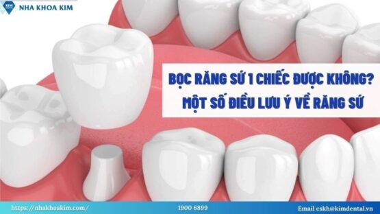 Bọc Răng Sứ 1 Chiếc Được Không? Một Số Lưu Ý Về Răng Sứ