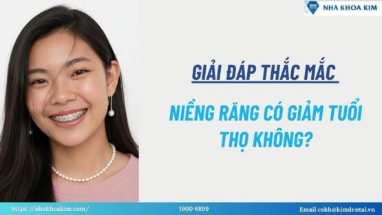 Giải Đáp Thắc Mắc: Niềng Răng Có Giảm Tuổi Thọ Không?